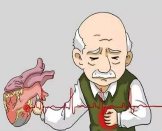 冠状动脉狭窄50%，不放支架怎样治？这里为您答疑解惑