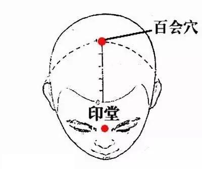 头疼怎么缓解？教你预防保健知识