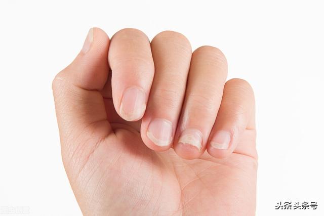 看名医叶天士如何治疗肝阳化风（肝风）三