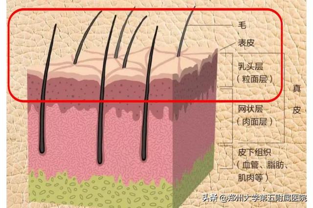 治疗宝宝的“红胎记”，您做对了吗？