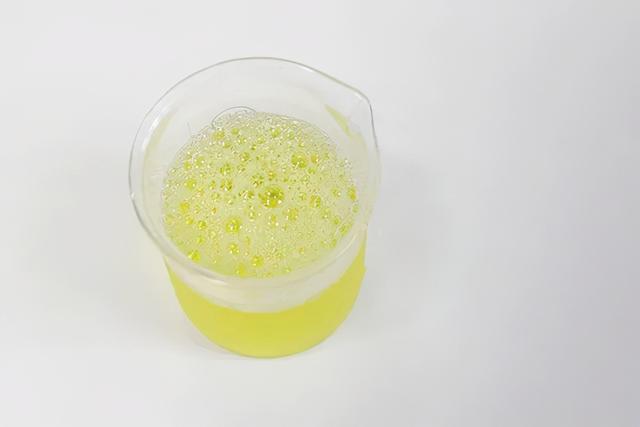 尿糖有加号是血糖太高了吗?看明白你可以了解的尿常规化验单