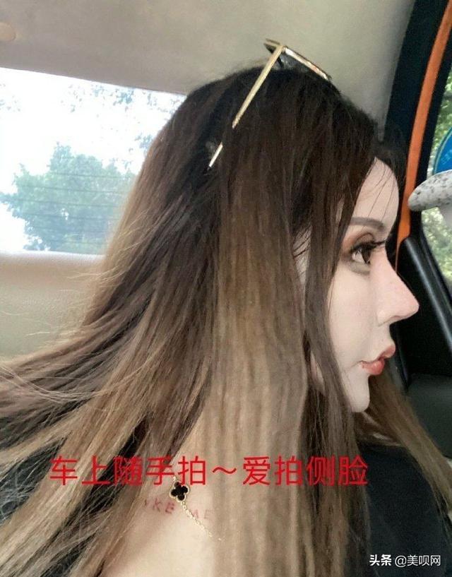 小娜娜整容图片