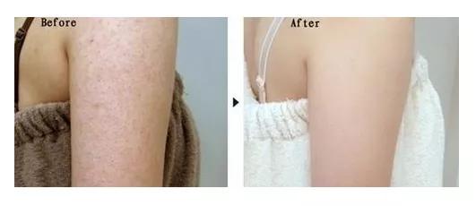 手工皂洗鸡皮肤