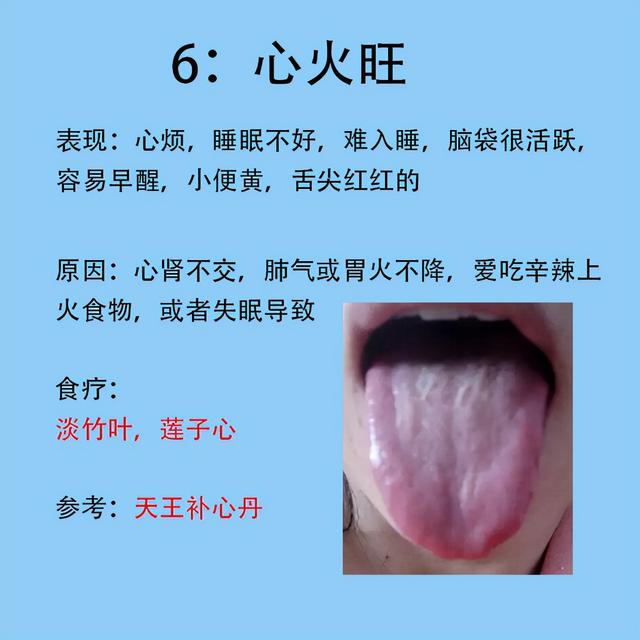 女人常见6种症状，以及对应舌象和解决的方法分享