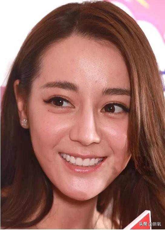 明星脸部毛周角化