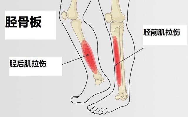 孩子没跑多久就出现小腿胫骨疼痛，这是怎么回事？还能运动吗？