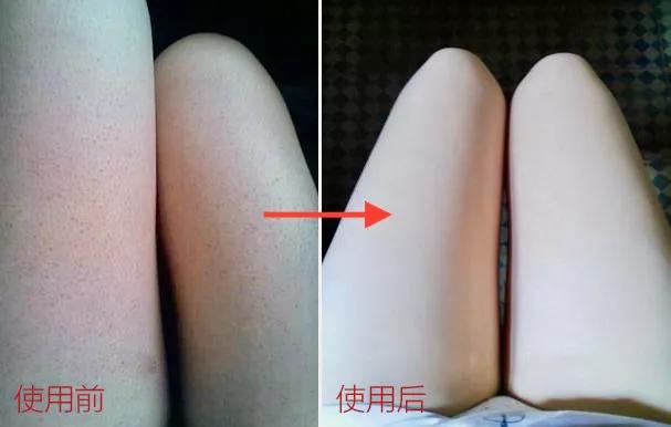 手工皂洗鸡皮肤