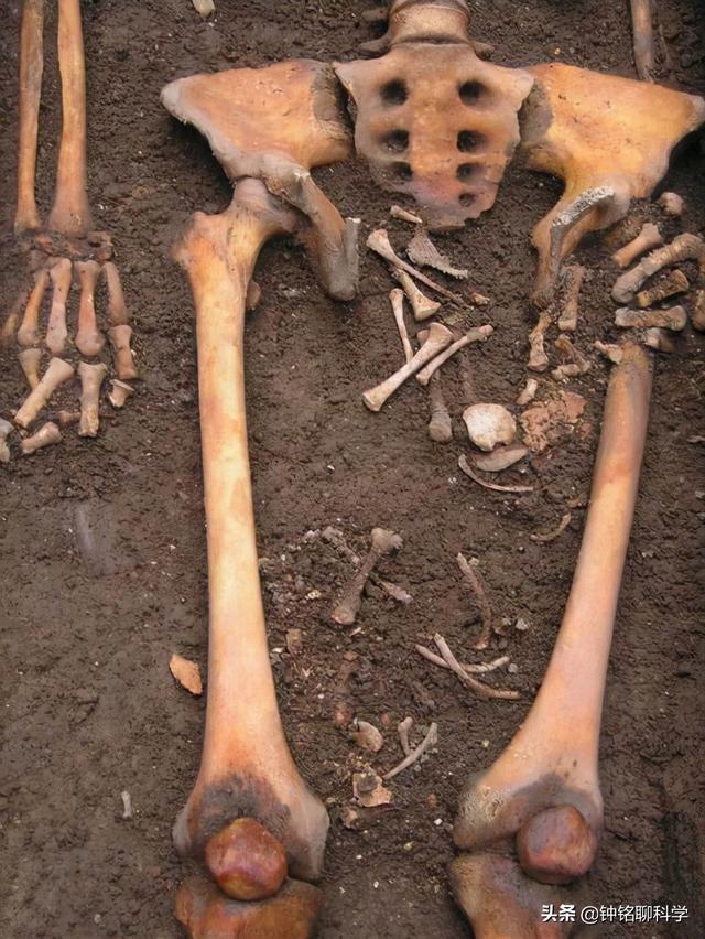 梦到死人骨头是什么意思 梦到死人骨头是什么意思(梦到骨头架子是什么