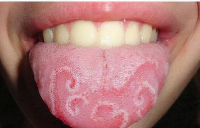 一个小孩子“不吃饭”的好方子