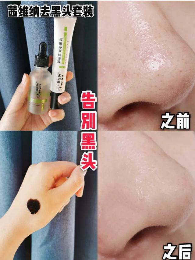 维a酸乳膏可以去周角化