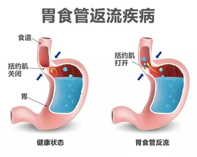 消化系统不好怎么办