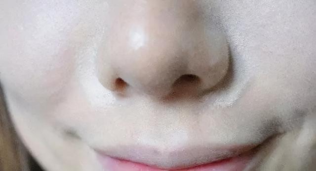 打完水光针毛周角化