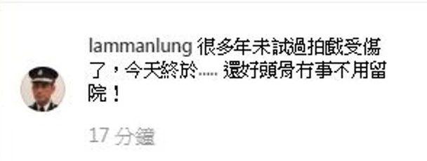 曾凭《不懂撒娇的女人》人气爆灯 TVB人气男神为拍新剧不慎受伤