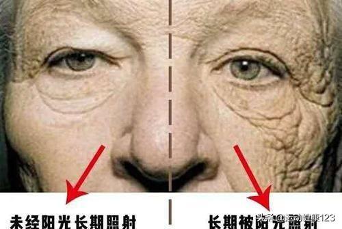 唇部日光性角化病
