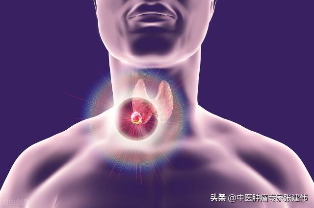 女子兩年沒復查，甲狀腺結節變成癌！醫生：這幾類結節很危險
