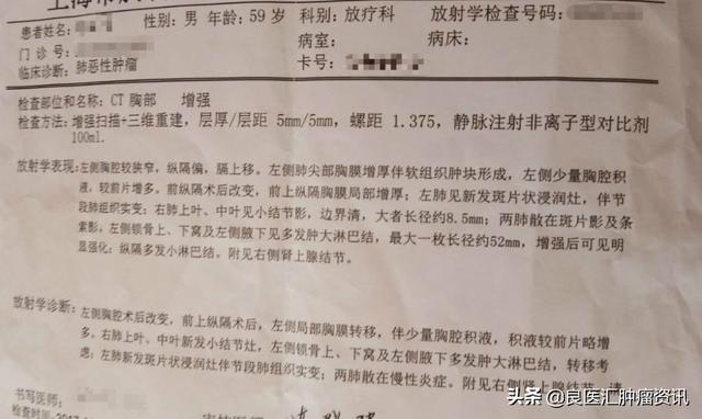 右肺上叶非角化型鳞状癌