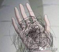 金克拉是什么