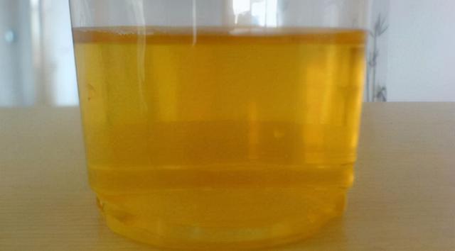 早上一起床，有这5个表现，医生：你很健康