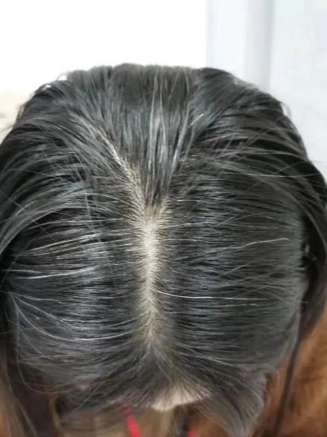 白发终于转黑了