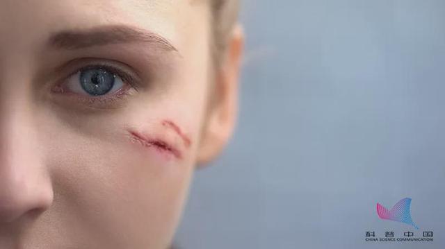 皮肤角化珠图片