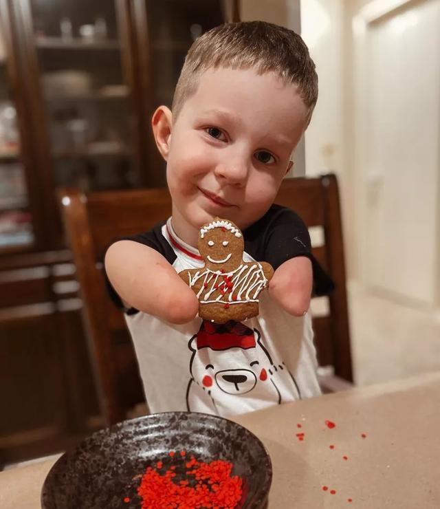 B超婴儿无四肢，18岁妈妈拒绝堕胎，冒险生子，把孩子养成男子汉