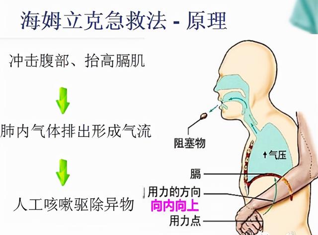 又一个孩子被异物卡喉了，幸好身旁有人懂得“顶他个肺”