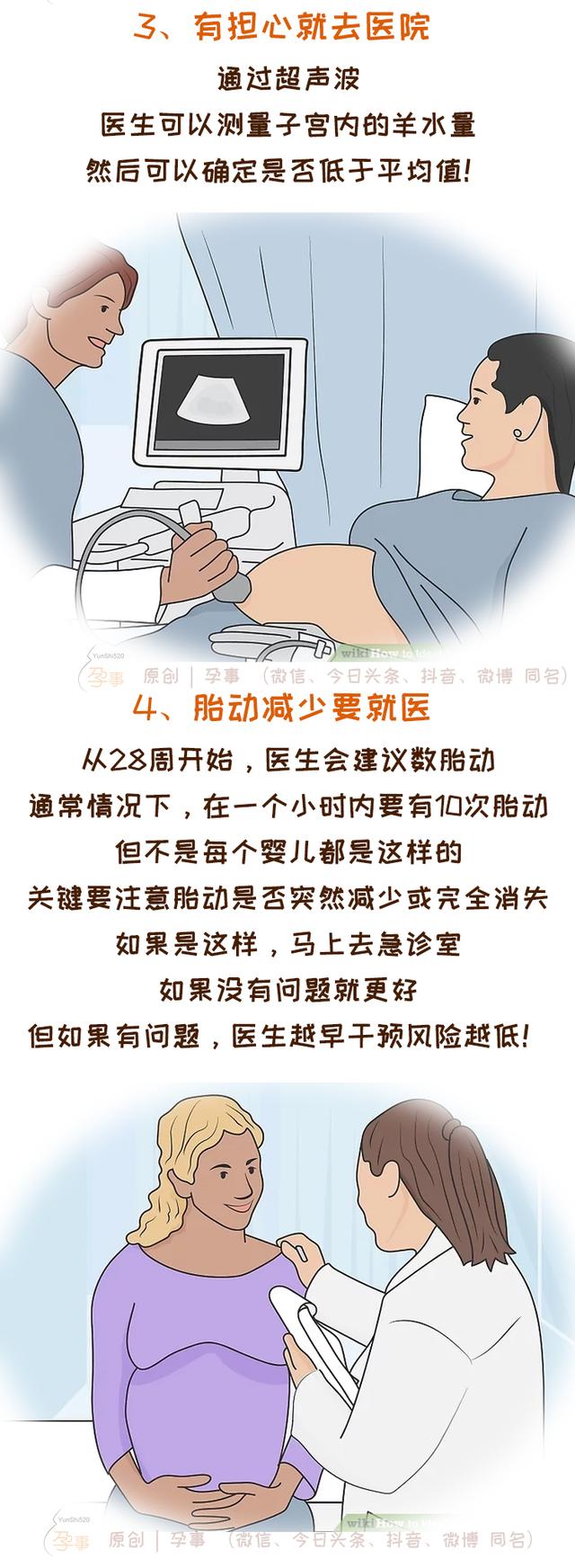 羊水破了是什么样的