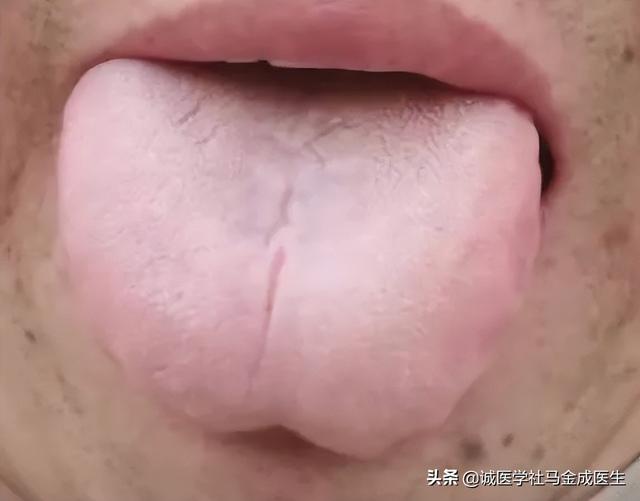 湿热、痰湿、寒湿如何区分？常见的表现是什么？哪些中药可以参考
