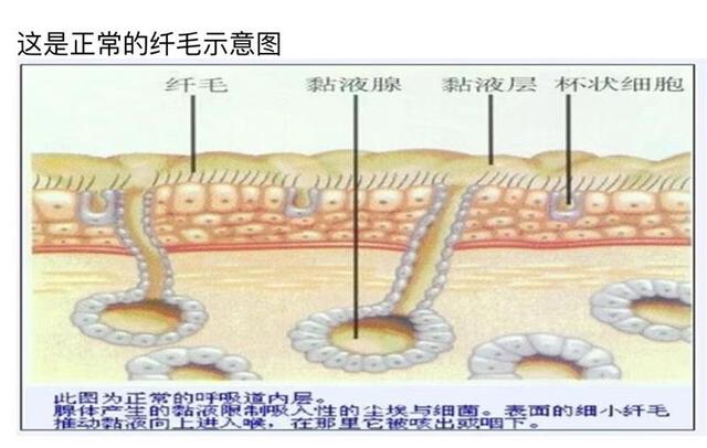 同样是咳嗽，为什么有的人是干咳，有的人咳嗽会大量吐痰呢？