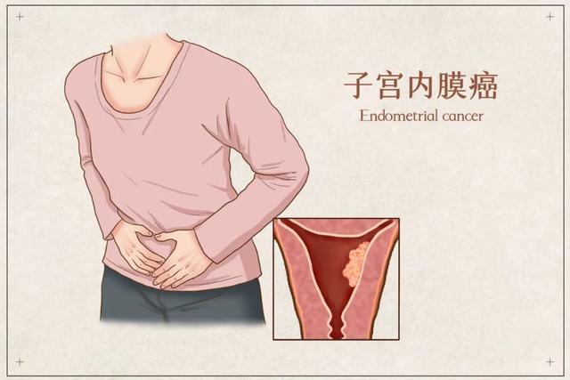 一查就晚期？其實身體早已發出預警