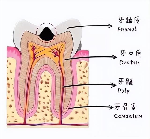 牙齿上有黑色的东西洗不掉怎么办