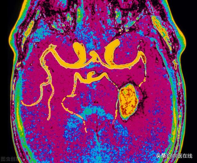 服用阿托伐他汀（他汀类药物），能不能停药？安不安全？