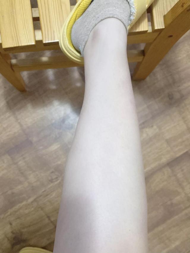 腿部鸡皮肤涂什么