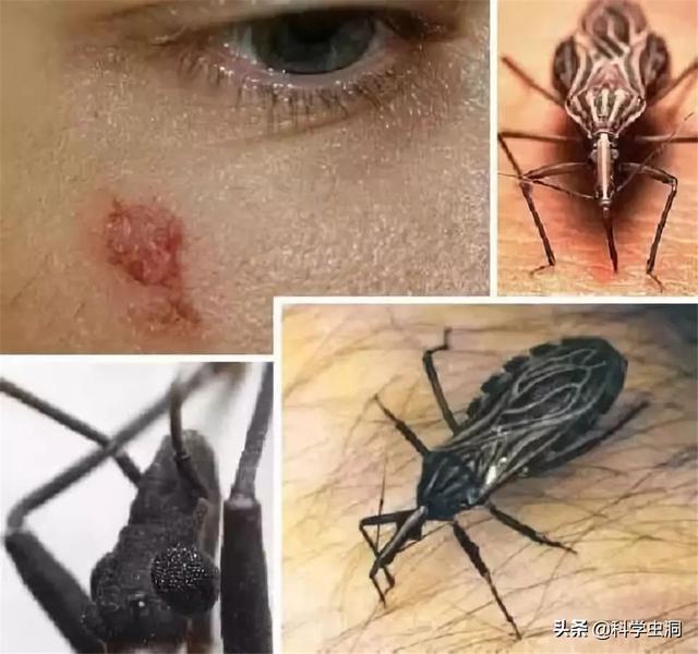 杀人最多的七种动物，第一种蚊子每年致死超72万人，你认识几种？-第5张图片-趣闻屋