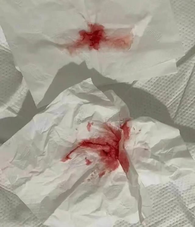 那个被下病危通知书的留学女孩