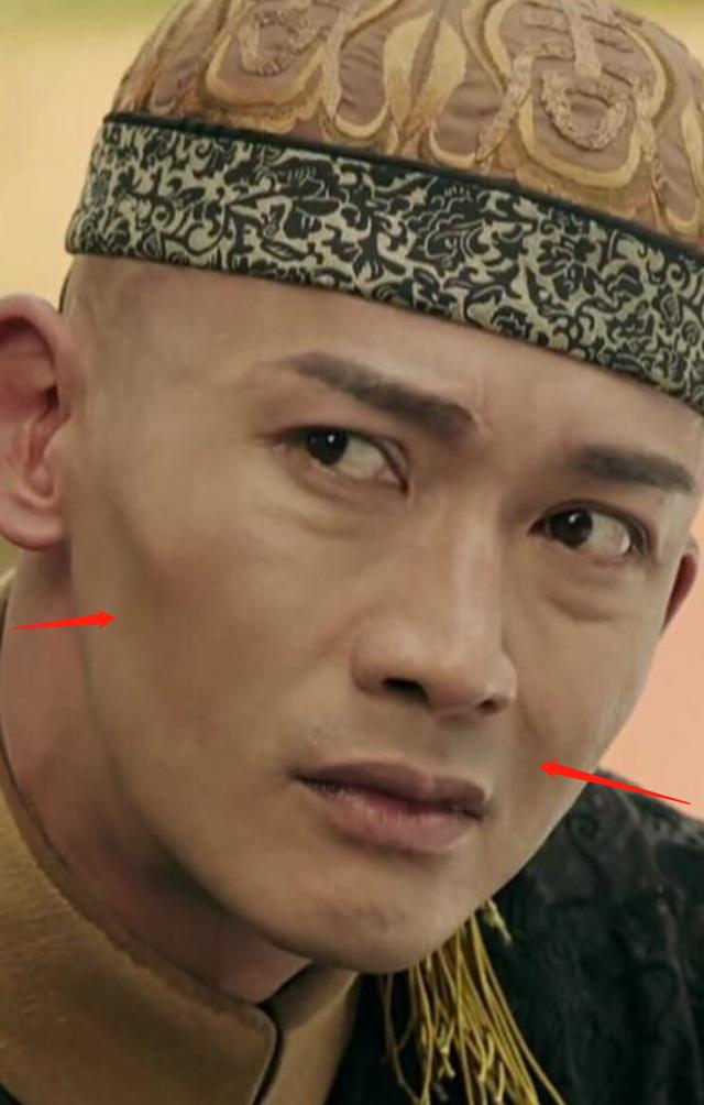 明星频翻车医美需谨慎！有人脸变充气气球，有人下巴变天气预报