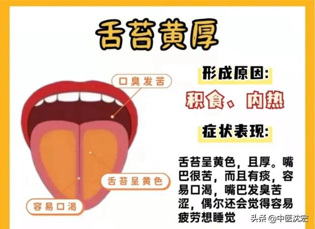 中医：从舌头看健康，舌象分析，常见的6种舌苔问题！和调理建议