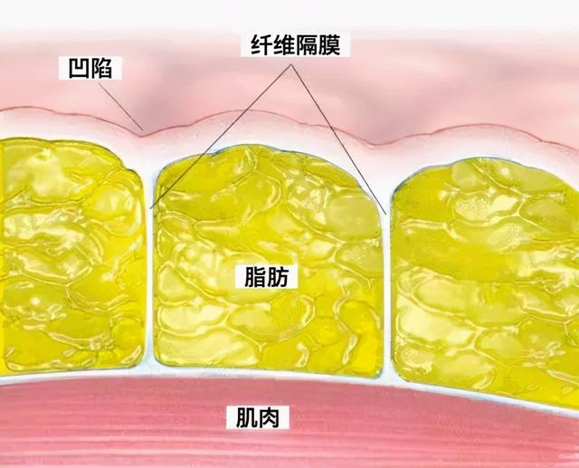 坑坑洼洼是什么意思