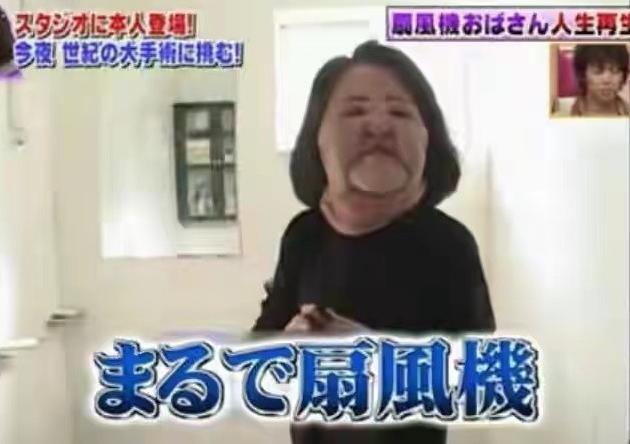 韩慧景：把自己整成“电风扇”，注射食用油代价惨痛，我悔不当初