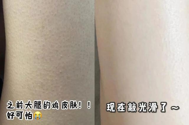 鸡皮肤哪个牌子好