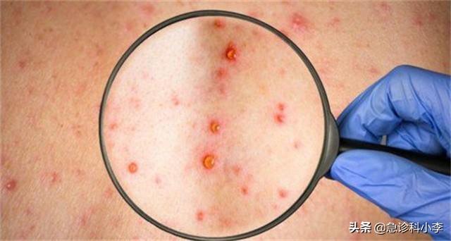 胳膊上好多小红点