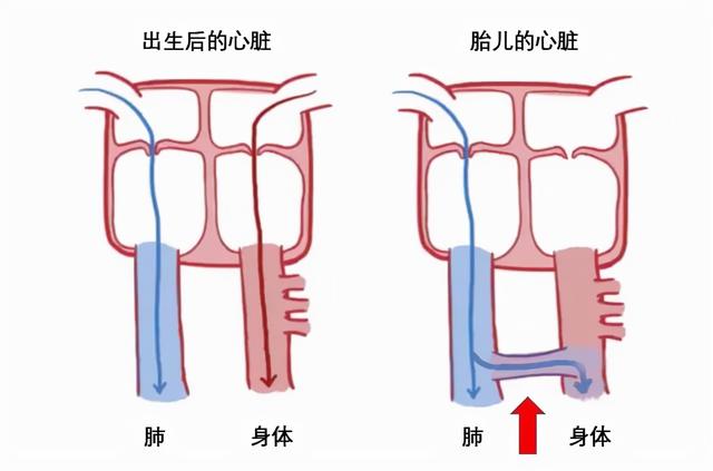 心脏是怎么长大的：第2篇——满是“漏洞”的心脏