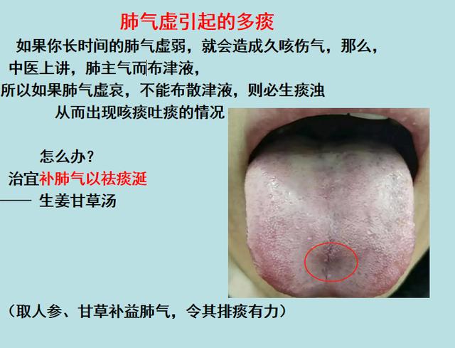 嗓子里总有痰，痰多吐不完？3个小方法，教你切断生痰之源