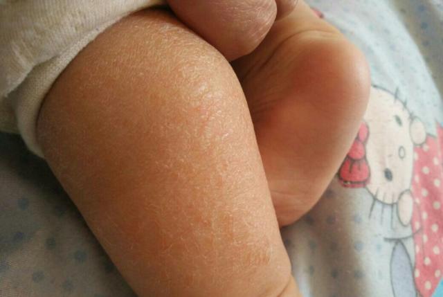 婴儿需不需要抹身体乳