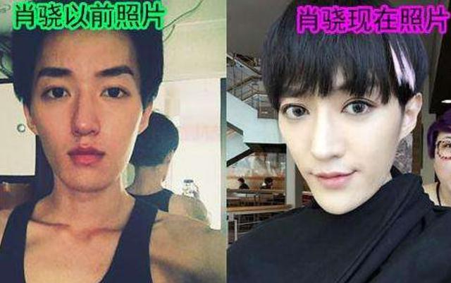 明星频翻车医美需谨慎！有人脸变充气气球，有人下巴变天气预报