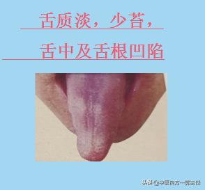 临床常见的9种舌象，对照自测