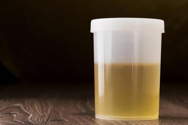 喝水后多久排尿说明肾脏很健康？医生：结合尿量判断更可靠