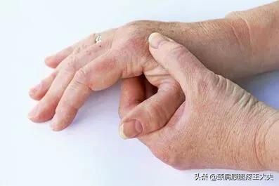 什么是痛风性关节炎？诊断依据是什么？这个方子可调