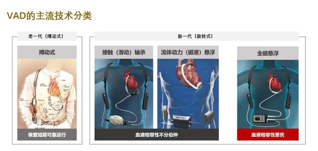 心衰患者植入人工心脏 950 天