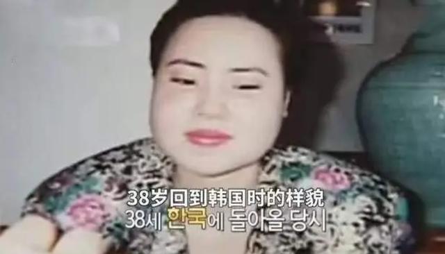 2018年韩慧景去世，年轻时在脸上注射色拉油，因整容过度几乎毁容